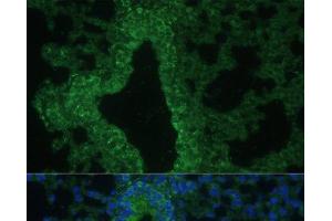 Immunofluorescence analysis of Mouse lung cells using IL25 Polyclonal Antibody at dilution of 1:100.