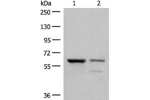Western blot analysis of Human left kidney cancer tissue and HEPG2 cell lysates using HNF1A Polyclonal Antibody at dilution of 1:200 (HNF1A anticorps)