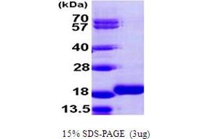 SDS-PAGE (SDS) image for Microtubule-Associated Protein 1 Light Chain 3 beta 2 (MAP1LC3B2) (AA 1-120) protein (His tag) (ABIN667441) (MAP1LC3B2 Protein (AA 1-120) (His tag))