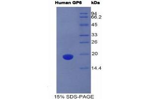 SDS-PAGE (SDS) image for Glycoprotein VI (Platelet) (GP6) (AA 86-231) protein (His tag) (ABIN1981021)
