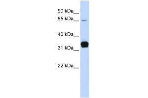 WB Suggested Anti-TNNT1 Antibody Titration:  0.