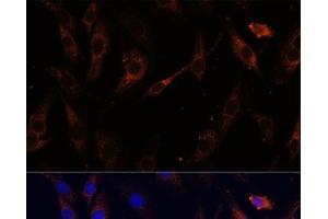 Immunofluorescence analysis of C6 cells using VPS25 Polyclonal Antibody at dilution of 1:100 (40x lens).