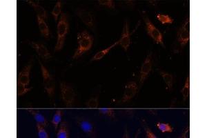 Immunofluorescence analysis of C6 cells using VPS25 Polyclonal Antibody at dilution of 1:100 (40x lens). (VPS25 anticorps)