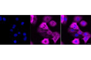 anti-N-Myc Downstream Regulated 1 (NDRG1) antibody