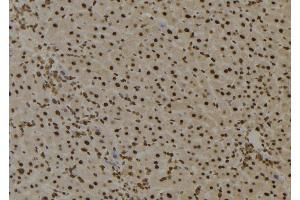 ABIN6276735 at 1/100 staining Mouse liver tissue by IHC-P. (BTK anticorps  (Internal Region))