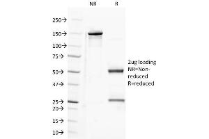 SDS-PAGE Analysis Purified CD100 Mouse Monoclonal Antibody (A8).