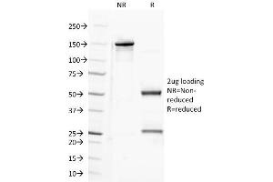 SDS-PAGE Analysis Purified CD100 Mouse Monoclonal Antibody (A8). (SEMA4D/CD100 anticorps)