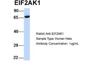 Host:  Rabbit  Target Name:  EIF2AK1  Sample Type:  Human Hela  Antibody Dilution:  1. (EIF2AK1 anticorps  (N-Term))