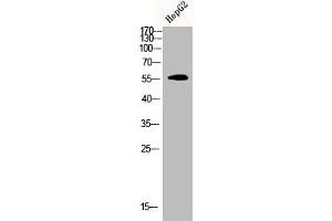 Western Blot analysis of HEPG2 cells using CDYL2 Polyclonal Antibody (CDYL2 anticorps  (N-Term))