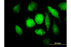 Immunofluorescence of purified MaxPab antibody to MAOB on HeLa cell.