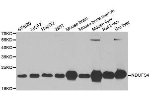 Western blot analysis of extracts of various cell lines, using NDUFS4 antibody. (NDUFS4 anticorps  (AA 1-175))