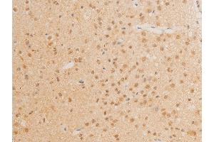 ABIN6267272 at 1/100 staining mouse brain tissue sections by IHC-P. (c-MYC anticorps  (pThr58))