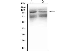 Western blot analysis of GRIK1 using anti-GRIK1 antibody (ABIN3042430). (GRIK1 anticorps  (AA 271-450))