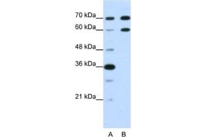 Western Blotting (WB) image for anti-Doublesex and Mab-3 Related Transcription Factor 2 (DMRT2) antibody (ABIN2462015) (DMRT2 anticorps)