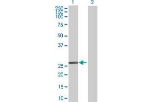 Western Blot analysis of DCXR expression in transfected 293T cell line by DCXR MaxPab polyclonal antibody. (DCXR anticorps  (AA 1-244))