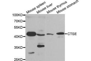 Western blot analysis of extracts of various cell lines, using CTSE antibody (ABIN5971444) at 1/200 dilution. (Cathepsin E anticorps)