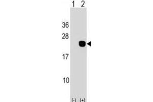 Western Blotting (WB) image for anti-DCMP Deaminase (DCTD) antibody (ABIN2998895) (DCMP Deaminase (DCTD) anticorps)