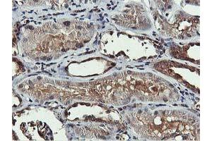 Image no. 4 for anti-V-Akt Murine Thymoma Viral Oncogene Homolog 1 (AKT1) antibody (ABIN1496555)