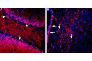 Expression of SGLT1 in rat brain sections - Immunohistochemical staining of perfusion-fixed frozen rat brain sections using Anti-SGLT1 (extracellular) Antibody (ABIN7043735, ABIN7044491 and ABIN7044492), (1:400).