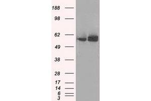 Image no. 5 for anti-ATP Synthase, H+ Transporting, Mitochondrial F1 Complex, beta Polypeptide (ATP5B) antibody (ABIN1496769)