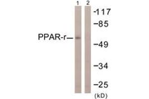 Western blot analysis of extracts from HuvEc cells, using PPAR-gamma (Ab-112) Antibody. (PPARG anticorps  (AA 78-127))