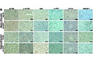 Exogenous BMP4 attenuates the development and progression of NAFLD by suppressing the mTORC1 signaling pathway.