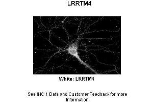 Sample Type :  Rat Hippocampal Neurons - 14DIV  Primary Antibody Dilution :  1:200  Secondary Antibody :  Anti-rabbit-Cy3  Secondary Antibody Dilution :  1:500  Color/Signal Descriptions :  White: LRRTM4  Gene Name :  LRRTM4  Submitted by :  Dan Fowler - University of Oregon, Institute of Neuroscience (LRRTM4 anticorps  (Middle Region))