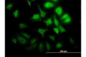 Immunofluorescence of monoclonal antibody to CCNG2 on HeLa cell.