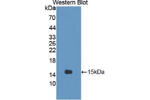 Western blot analysis of the recombinant protein. (CRTC3 anticorps  (AA 1-103))