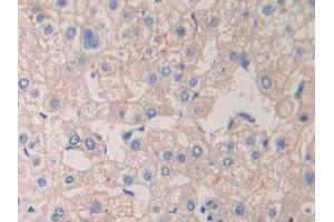 DAB staining on IHC-P; Samples: Human Liver Tissue (CrkL anticorps  (AA 1-303))