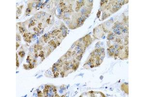Immunohistochemistry of paraffin-embedded Human stomach using MGP Polyclonal Antibody at dilution of 1:100 (40x lens).