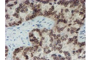 Image no. 4 for anti-SUMO1/sentrin/SMT3 Specific Peptidase 2 (SENP2) (AA 139-523) antibody (ABIN1490926) (SENP2 anticorps  (AA 139-523))