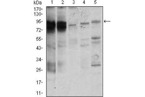 Western blot analysis using STAT5A antibody against K562 (1), MOLT4 (2), HeLa (3), Jurkat (4), and A431 (5) cell lysate. (STAT5A anticorps  (AA 583-794))