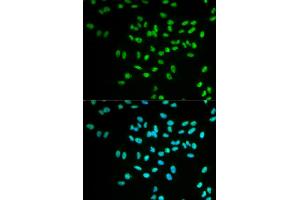 Immunofluorescence analysis of MCF-7 cells using FANCD2 antibody (ABIN5971101). (FANCD2 anticorps)