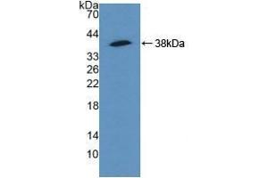 Detection of Recombinant ACTN4, Human using Polyclonal Antibody to Actinin Alpha 4 (ACTN4) (alpha Actinin 4 anticorps  (AA 1-269))