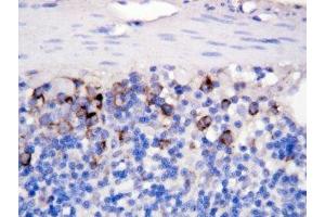 IHC-P: CD40L antibody testing of rat intestine tissue (CD40 Ligand anticorps  (N-Term))
