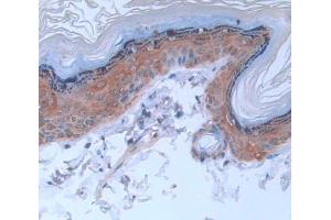 IHC-P analysis of Rat Tissue, with DAB staining. (Keratin 2 anticorps  (AA 508-685))