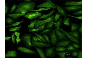 Immunofluorescence of monoclonal antibody to SEMA7A on HeLa cell.