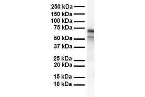 WB Suggested Anti-CES2 antibody Titration: 1 ug/mL Sample Type: Human heart (CES2 anticorps  (C-Term))