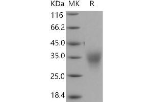 Western Blotting (WB) image for Activin A Receptor, Type IIB (ACVR2B) (Active) protein (His tag) (ABIN7320385)