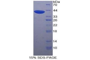 SDS-PAGE analysis of Human UGT8 Protein. (UGT8 Protéine)