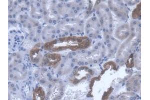 Detection of TST in Mouse Kidney Tissue using Polyclonal Antibody to Thiosulfate Sulfurtransferase (TST)