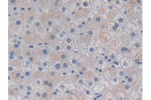 DAB staining on IHC-P; Samples: Human Liver Tissue (HSPB7 anticorps  (AA 1-170))