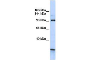 WB Suggested Anti-KIAA1024 Antibody Titration:  0. (KIAA1024 anticorps  (C-Term))
