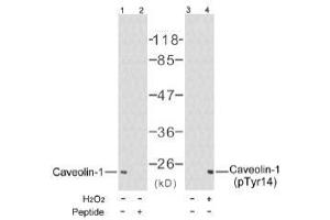 Image no. 1 for anti-Caveolin 1, Caveolae Protein, 22kDa (CAV1) (Tyr14) antibody (ABIN197289) (Caveolin-1 anticorps  (Tyr14))
