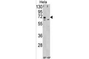 Western blot analysis of LMOD1 Antibody (Center N201) in Hela cell line lysates (35ug/lane). (Leiomodin 1 anticorps  (Middle Region))