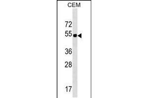 Western blot analysis in CEM cell line lysates (35ug/lane). (ELL3 anticorps  (C-Term))