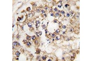 IHC analysis of FFPE human testis tissue stained with PDX1 antibody (PDX1 anticorps  (AA 40-69))