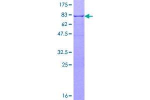 Aldehyde Dehydrogenase 1 Family, Member A1 (ALDH1A1) (AA 1-501) protein (GST tag)
