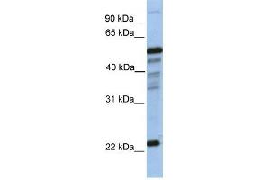 PGDS antibody used at 1 ug/ml to detect target protein. (PTGDS anticorps  (N-Term))